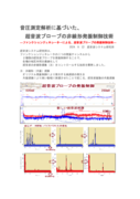 音圧測定解析に基づいた、超音波プローブの発振制御技術